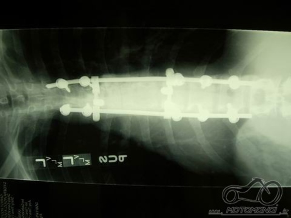 x-ray