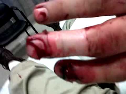 fingers caught in running motorcycle chain OOPS PT1 Honda CB750 Gore Faces Of Death smashed & cut